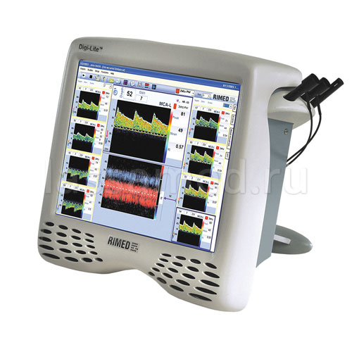 Для чего нужен транскраниальный доплер