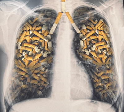 МЕЖДУНАРОДНЫЙ ДЕНЬ ОТКАЗА ОТ КУРЕНИЯ