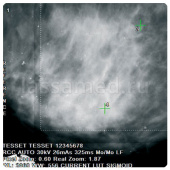 BIOPSY DIGIT для GIOTTO IMAGE